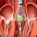 The Future of Cardiology: How Turkey is Pioneering TAVR Procedures